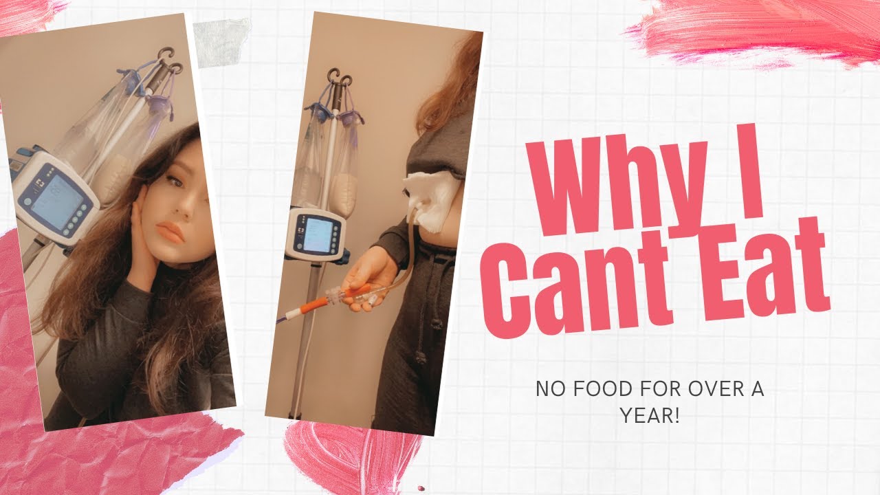 What it is like to not eat | Haven't had food in over a year!