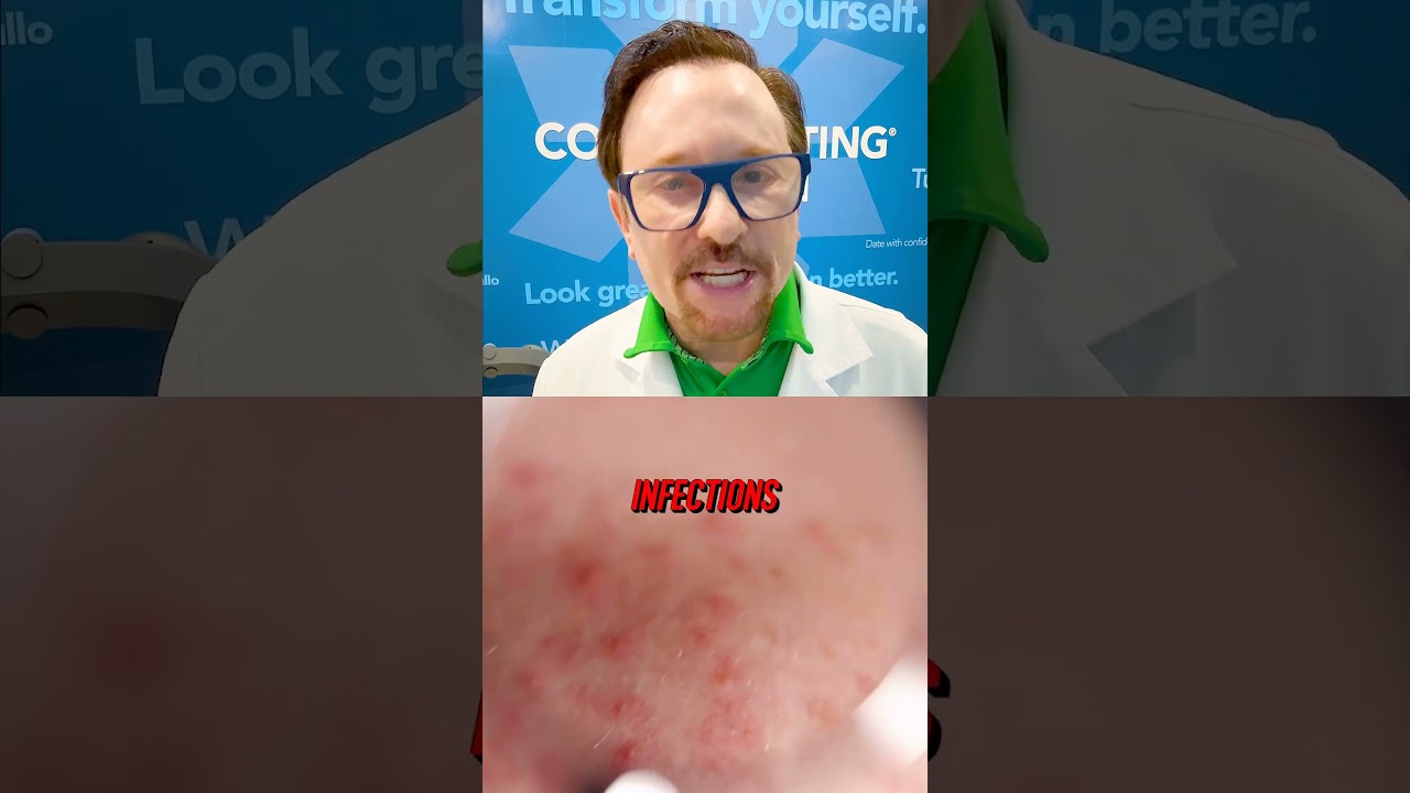 How Parasitosis RUINS Your Skin... #shorts #skincare #dermatology