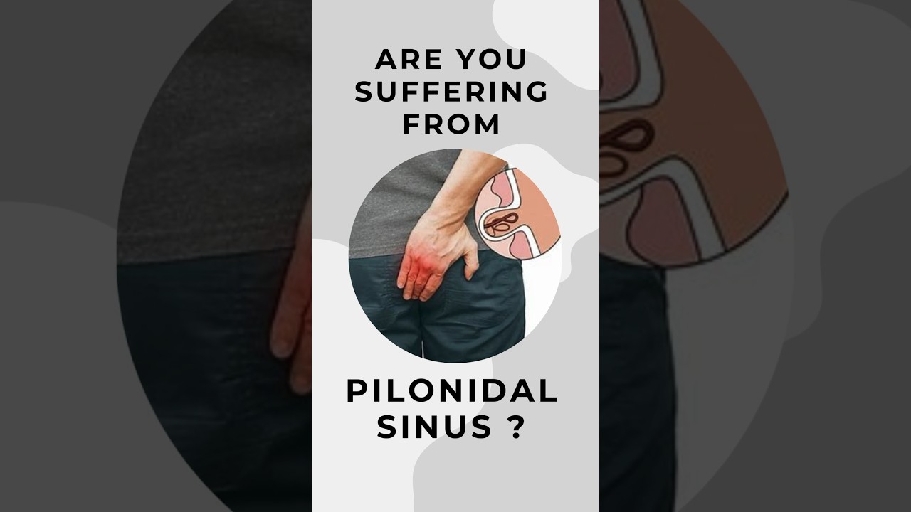 Suffering from Pilonidal Sinus I Pilonidal sinus treatment in Delhi