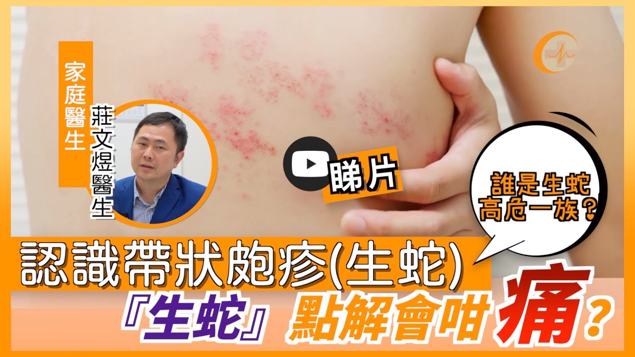 認識帶狀皰疹(生蛇)｜『生蛇』點解會咁痛？｜誰是高危一族？ 莊文煜醫生