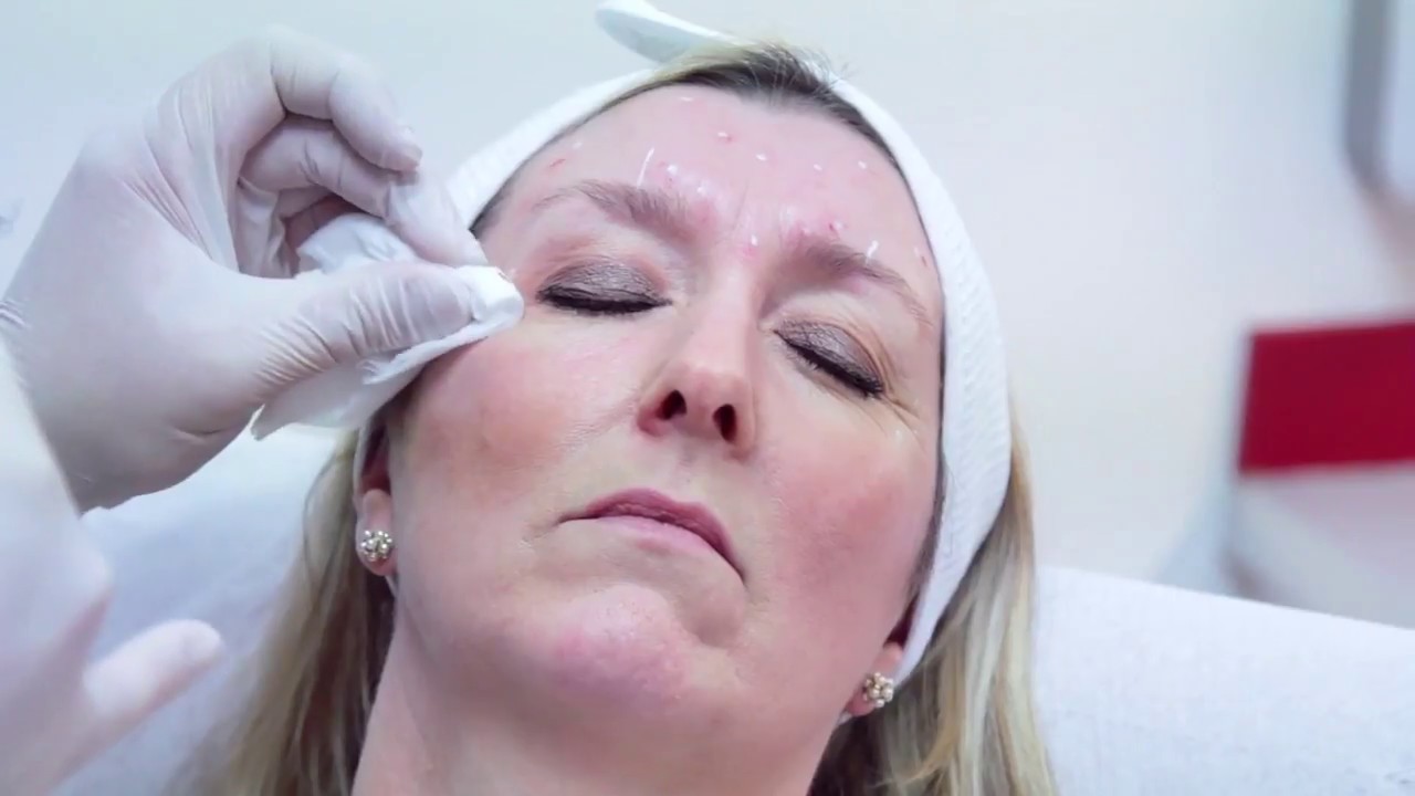 MATA Harley Street - Injectable Training Courses Patient Preparation