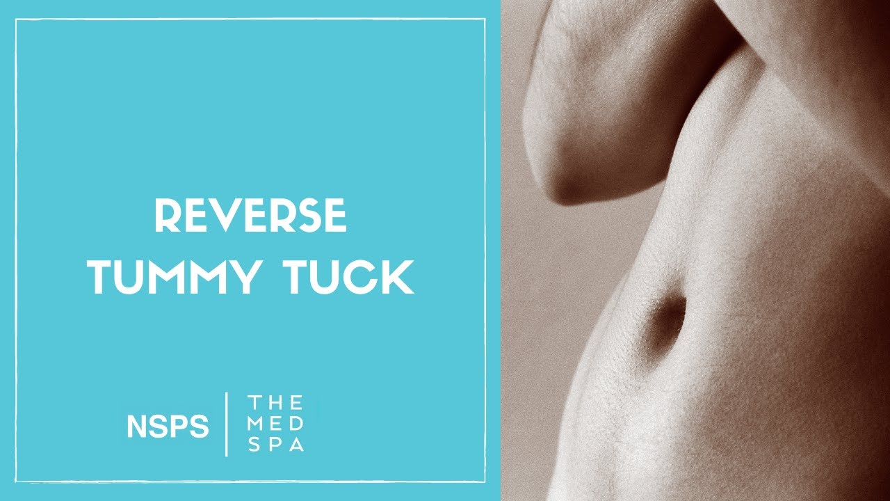 Reverse Tummy Tuck