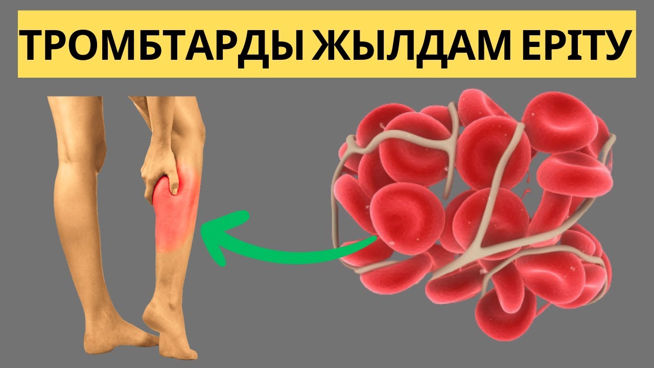 ТРОМБТЫ РАСЫМЕН ЖЫЛДАМ ЕРІТЕТІН ТАҒАМ ТҮРЛЕРІ / ТРОМБ ПАЙДА БОЛМАСЫН ДЕСЕҢІЗ / ҚОЮ ҚАН МӘҢГІГЕ ЖОҚ