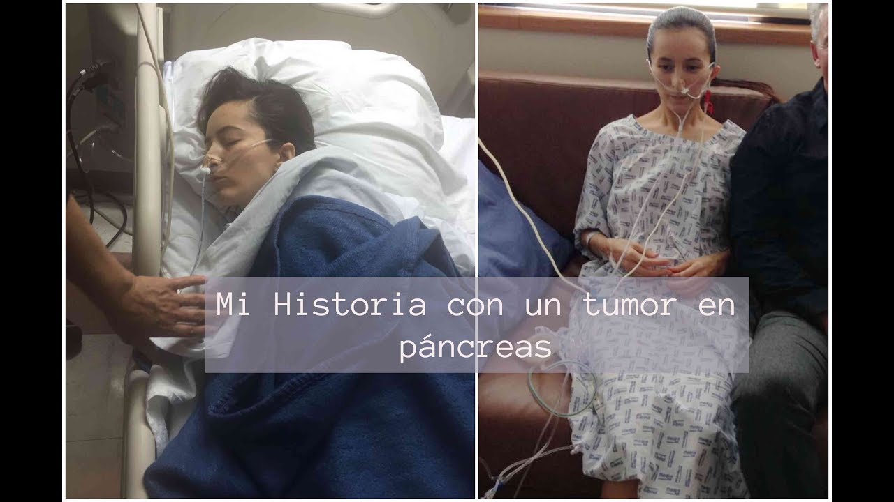 Mi Cirugia Whipple Parte 1
