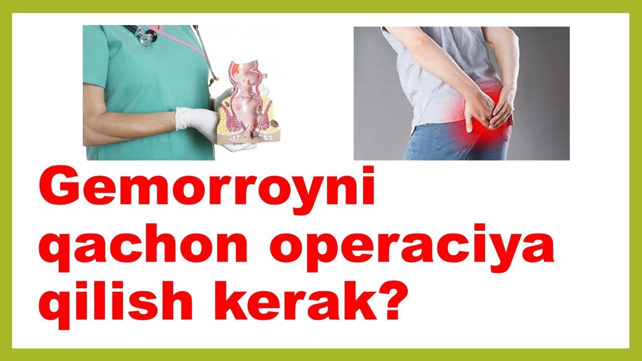 Gemorroyni qachon operatsiya qilish kerak