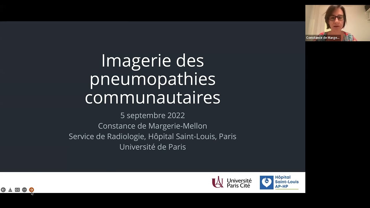 Imageries des Pneumopathies Communautaires