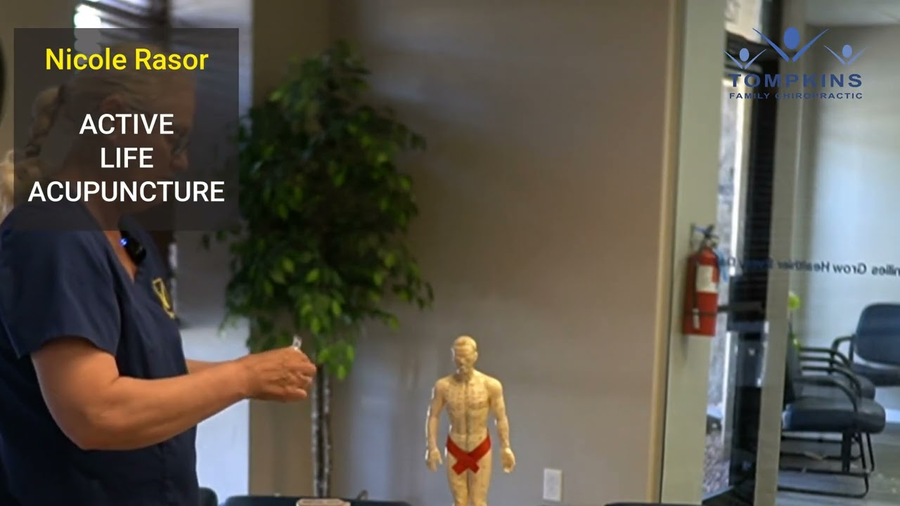 Exploring Acupuncture: A Journey with Nicole Rasor