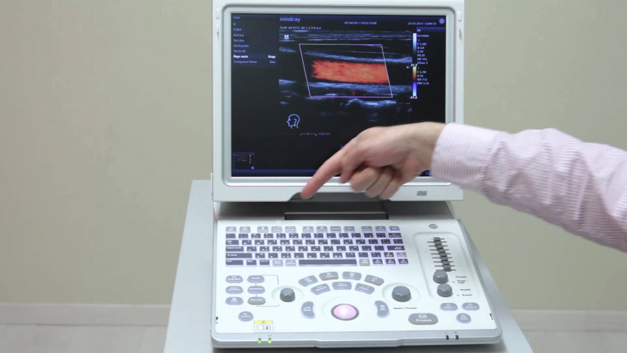 Mindray Z6 Tutorial (Spainish)--Portable Color Doppler Diagnostic Ultrasound System