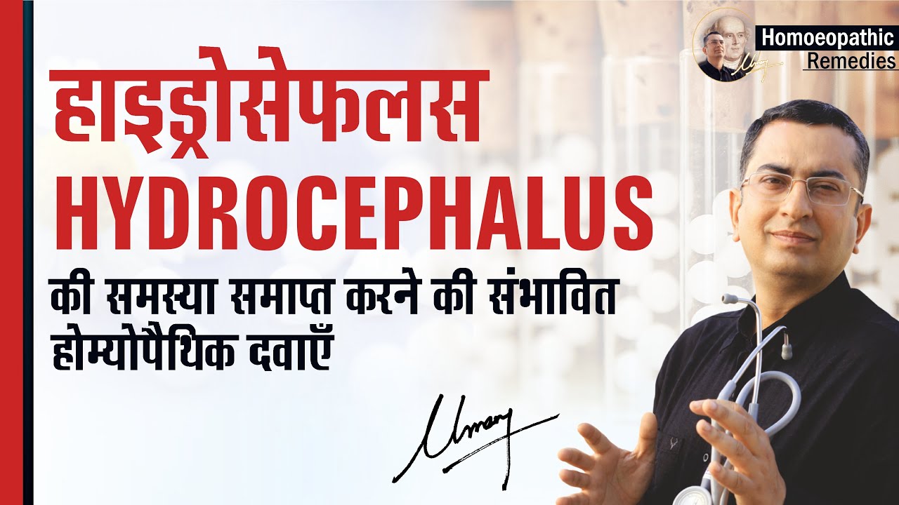 Hydrocephalus || Natural homeopathic remedies with symptoms