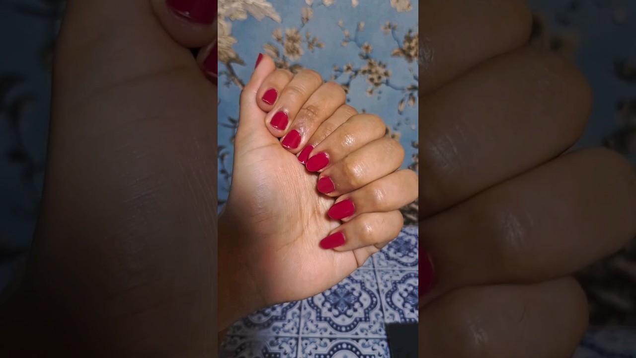 9 dedos em uma m&atilde;o! 😱