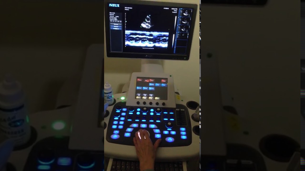 Siui Apogee 3300 Ekokardiyografi Performansı