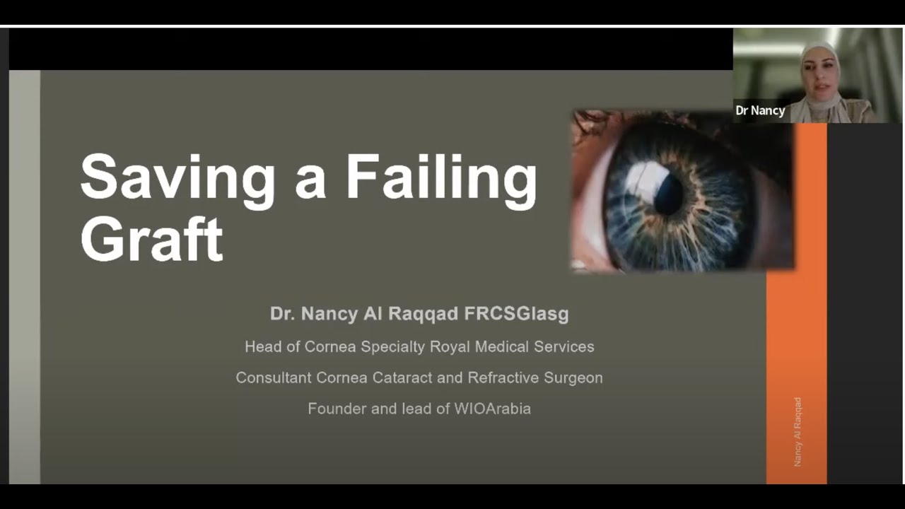 Cornea - To The Wonderland-saving the failing graft- Dr Nancy Al Raqqad