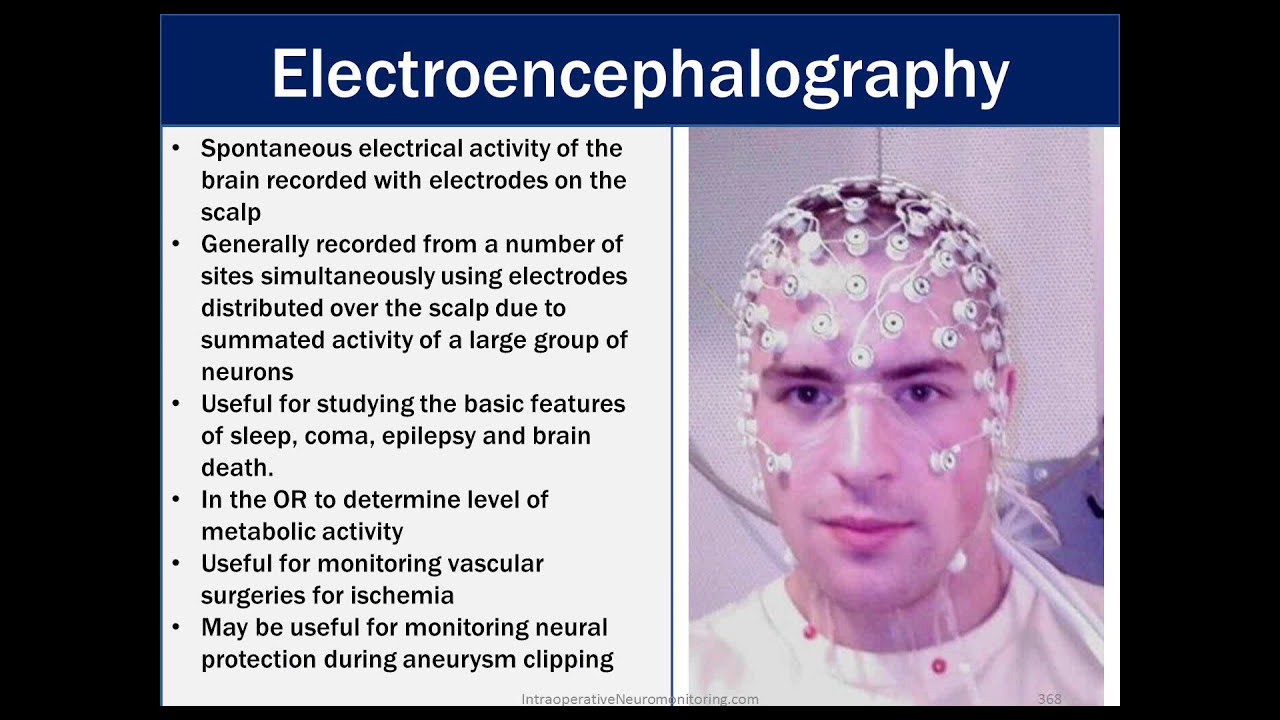 CNIM Crash Course 8 EEG