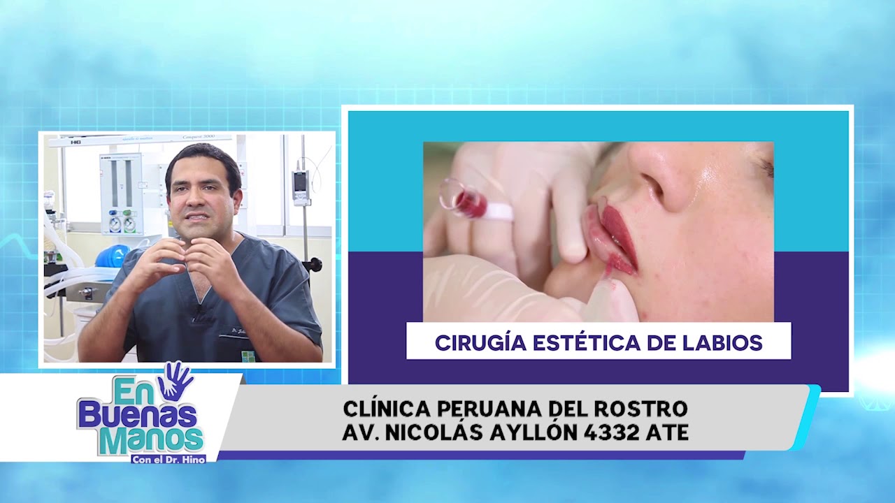 CIRUGÍA ESTÉTICA DE LABIOS- DR. JULIO GAVIDIA