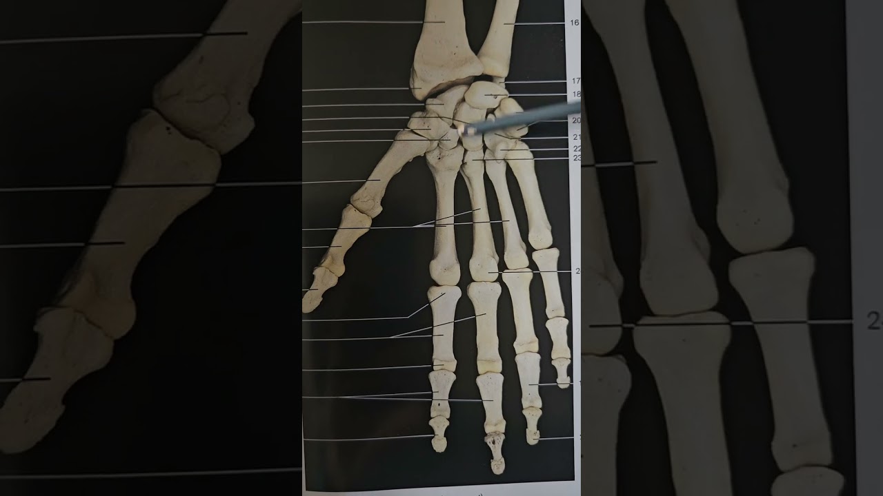 Anatomy Quizz, Part 54, #hand #bones #skeleton #number