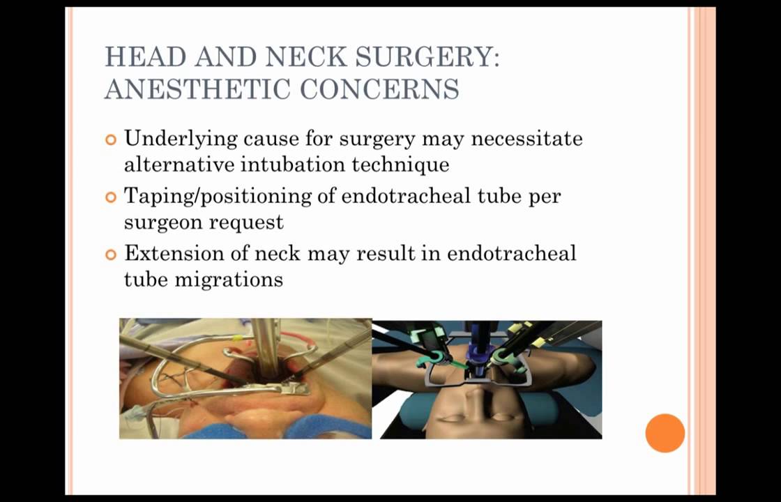 Anesthesia for Robotic Surgery