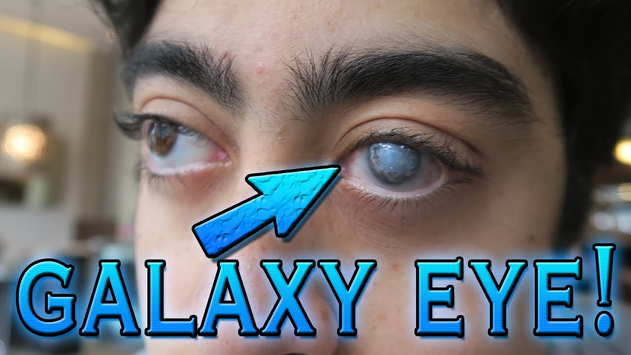 WHAT THE HELL HAPPENED TO HIS EYE!? (GALAXY EYE)