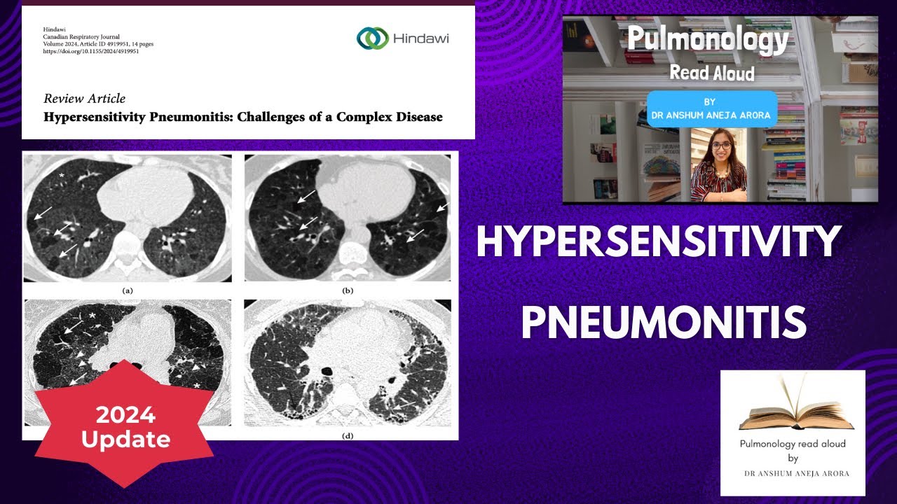 Hypersensitivity Pneumonitis Latest Insights 2024- A read aloud