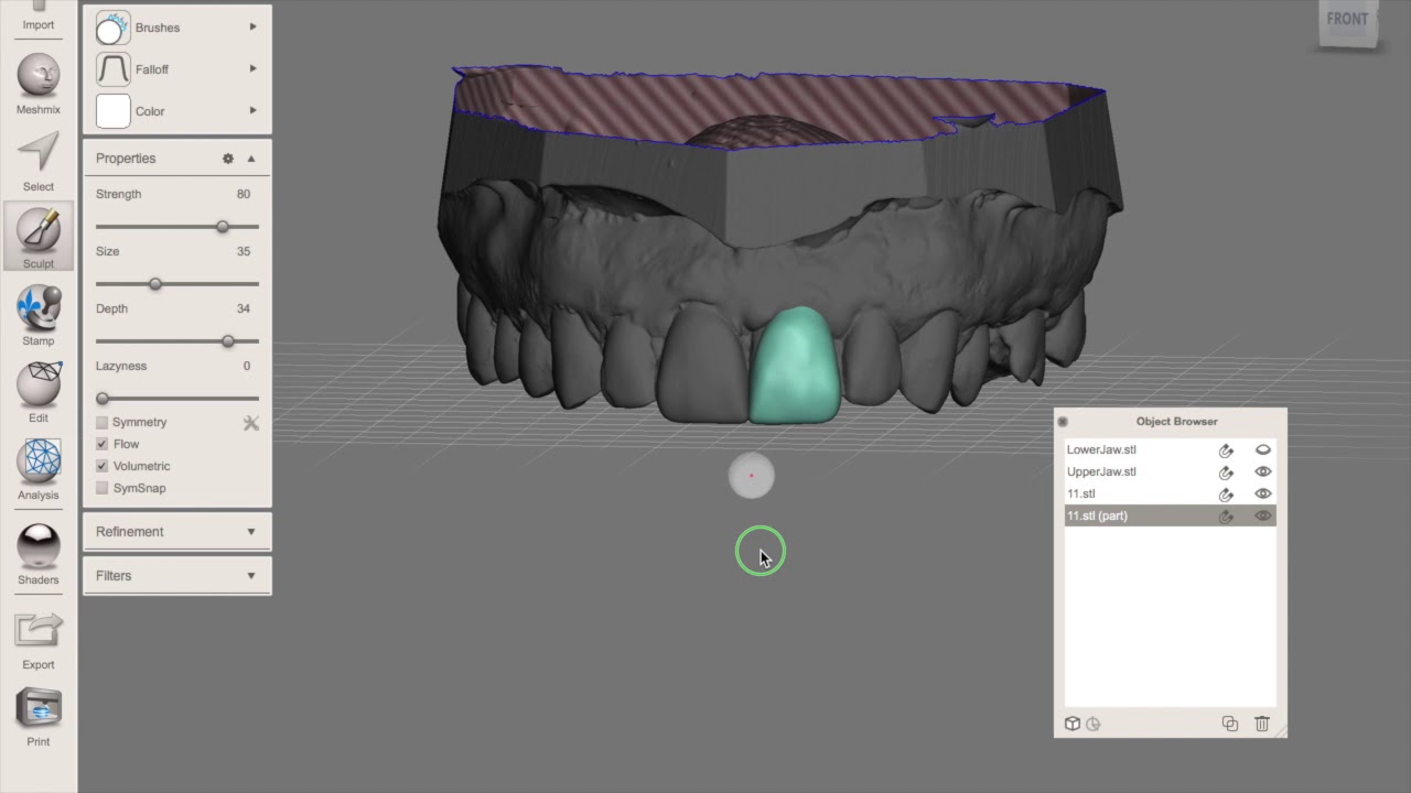 Meshmixer in dentistry digital waxup