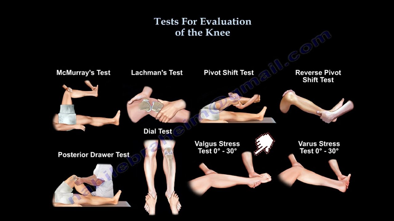 Tests For  Examination  Of The Knee - Everything You Need To Know - Dr. Nabil Ebraheim