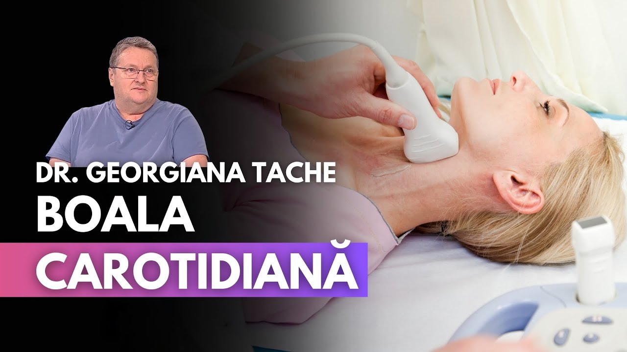 Boala carotidiană – Dr. Călin Popa, medic primar chirurgie cardiovasculară