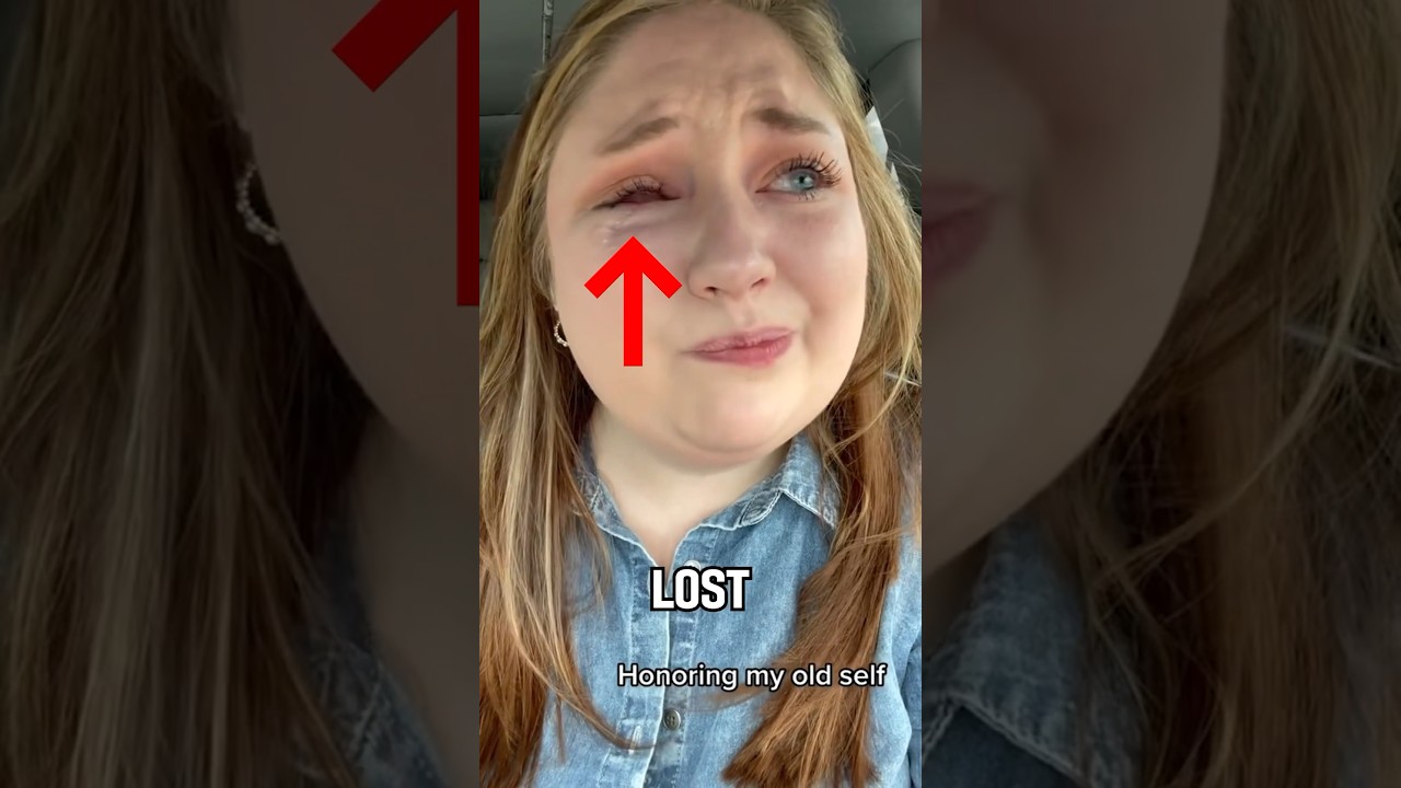 The reason she lost an eye (@hannahnoliver)