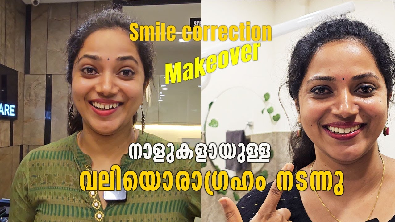 ചിരിയൊന്നു മാറ്റിയെടുത്തു ഒരുപാടുനാളത്തെ ആഗ്രഹം| Smile correction dental treatment|Come on everybody