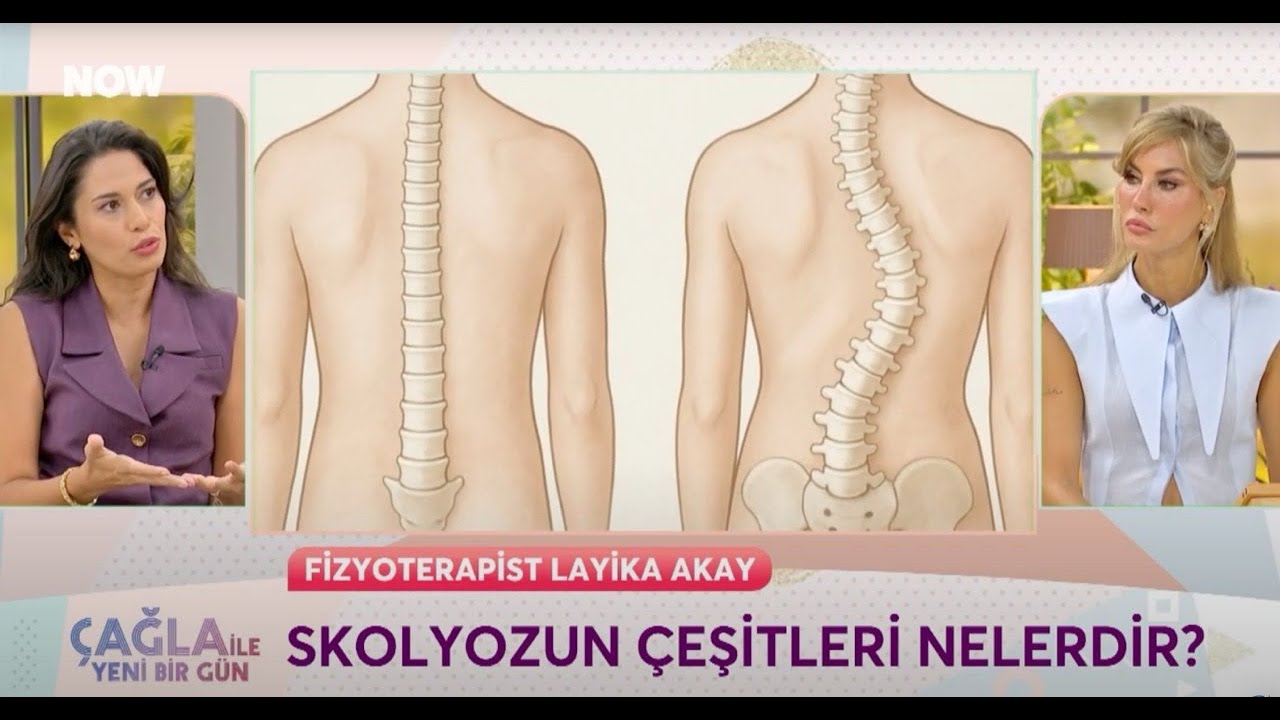 Çağımızın Hastalığı- Skolyoz ve Kifoz