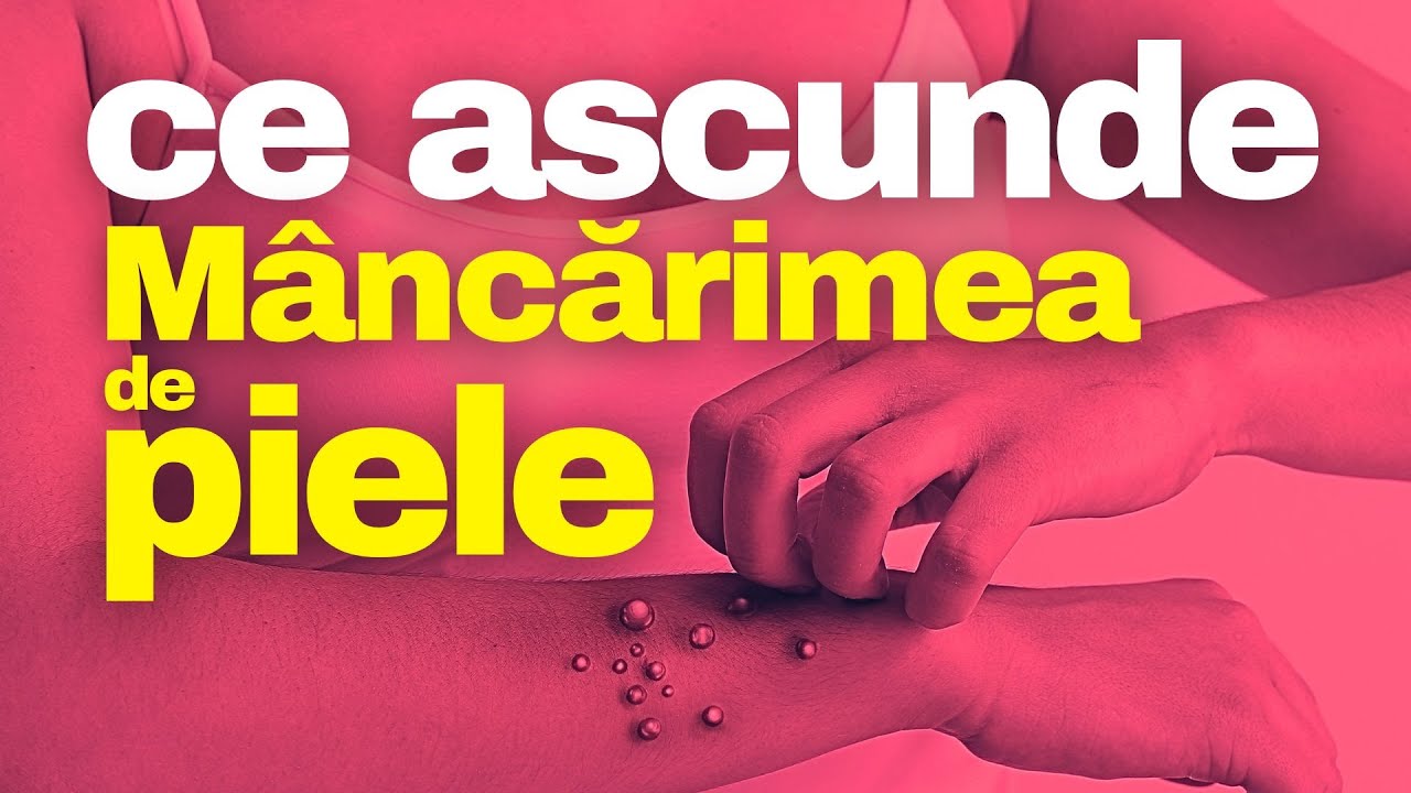 Ce poate să însemne când te MĂNÂNCĂ PIELEA