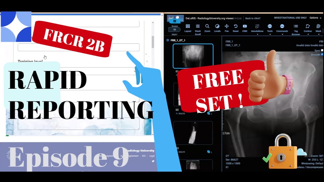 Episode 9: FRCR 2B free rapid reporting set