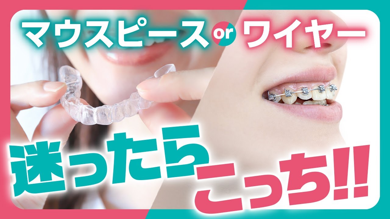 【歯列矯正】ワイヤーvsマウスピース！迷った場合は...！