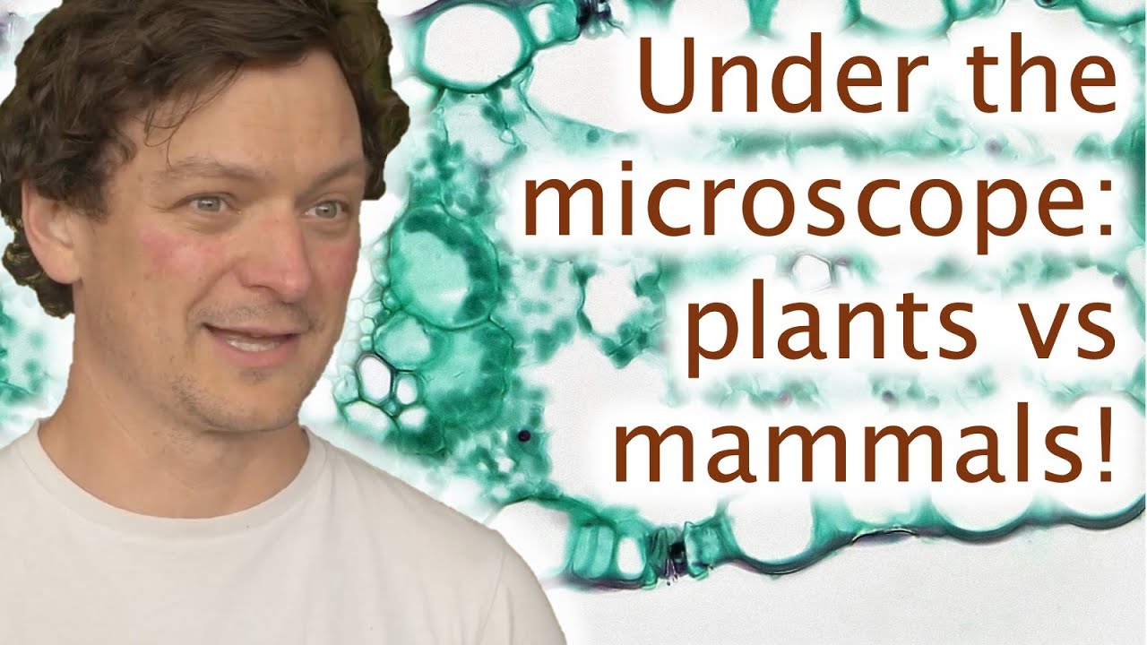 From Brain Cells to Plant Cells: An Unexpected Journey