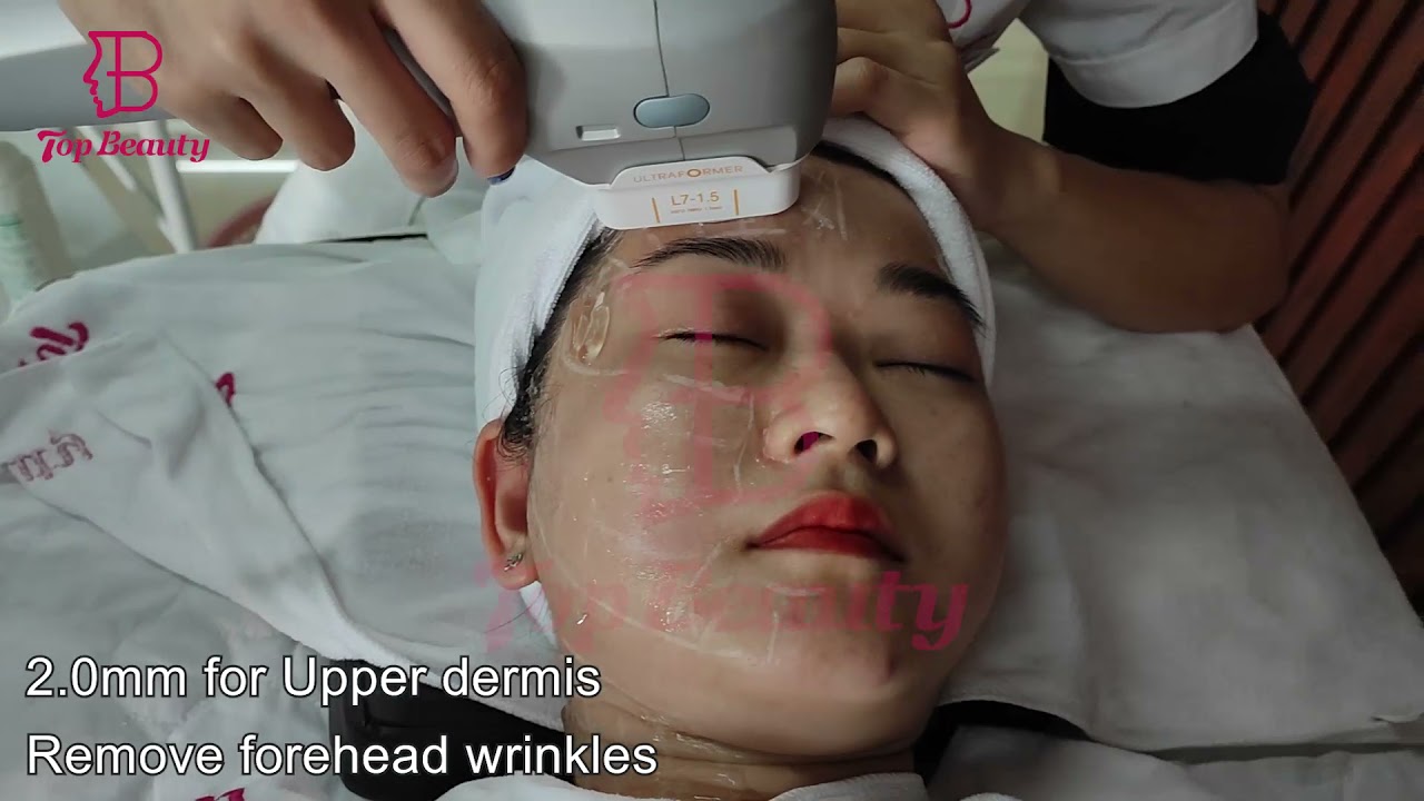7D HIFU treatment for face lifting and body slimming