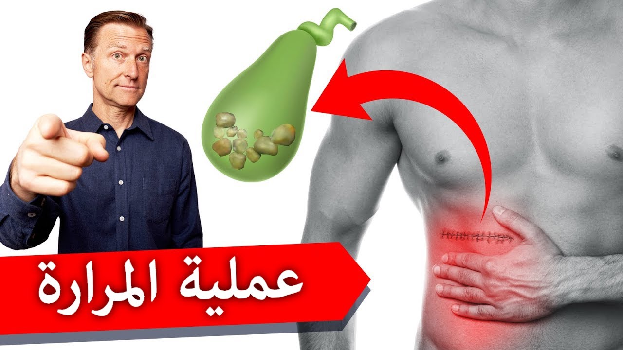 استئصال المرارة | مالا تعلمه عن تبعات عملية إزالة المرارة وأهميتها