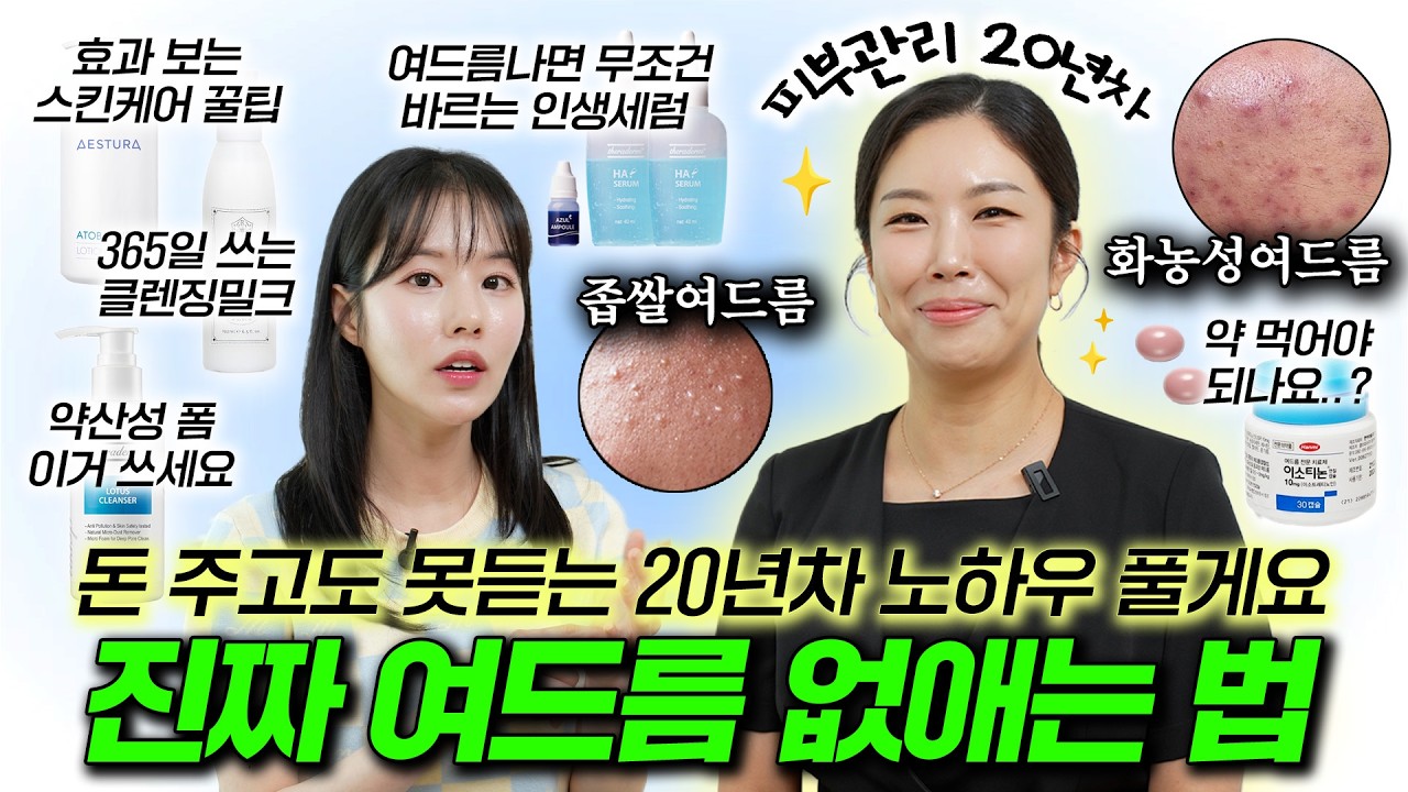 ⭐진짜 여드름 없애는 법⭐ 여드름관리 20년차 노하우 다 공개합니다 (세안법, 여드름약, 생활습관, 스킨케어 꿀팁 등 다 때려넣음)