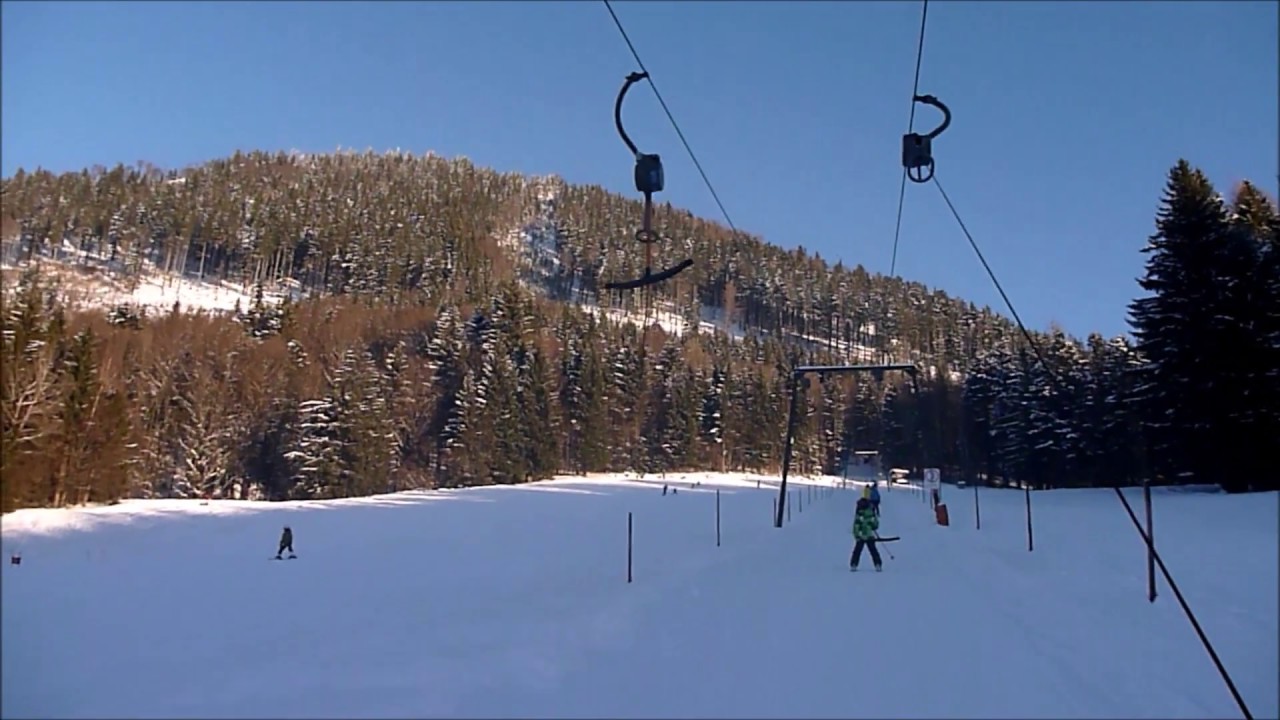 Kesselmannlift
