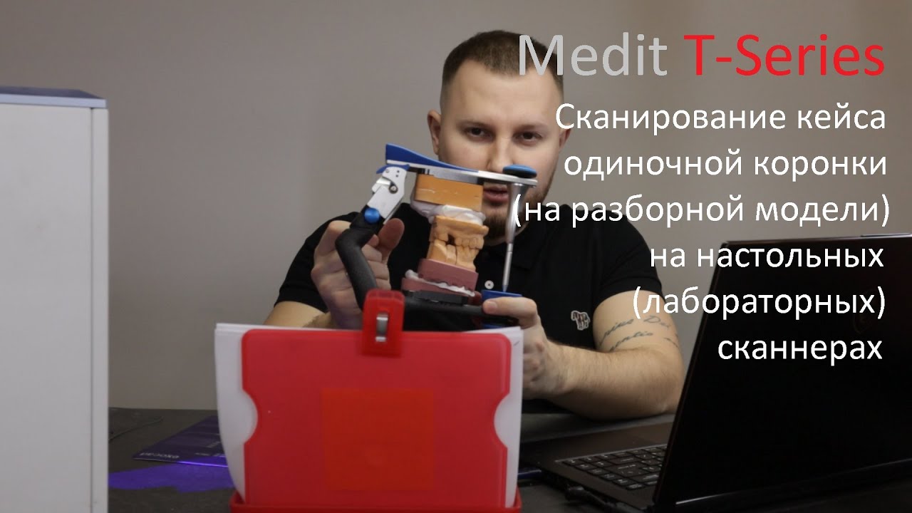 Сканирование кейса одиночной коронки на настольных(лабораторных) сканнерах / Medit T-Series