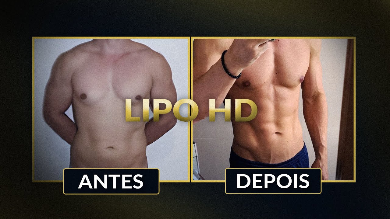 Antes e depois LipoHD masculina. LadSTRONG.
