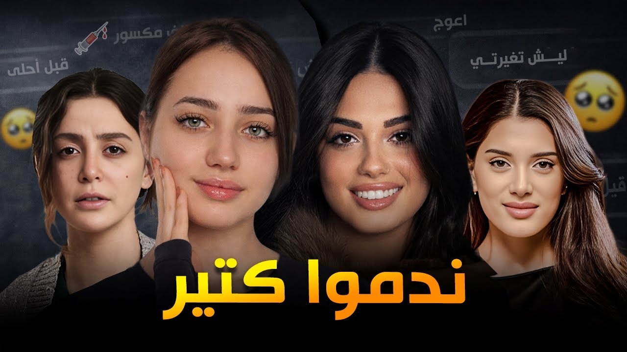 مشاهير غيّروا ملامحهم بسبب التنمر !  مين المسؤول؟