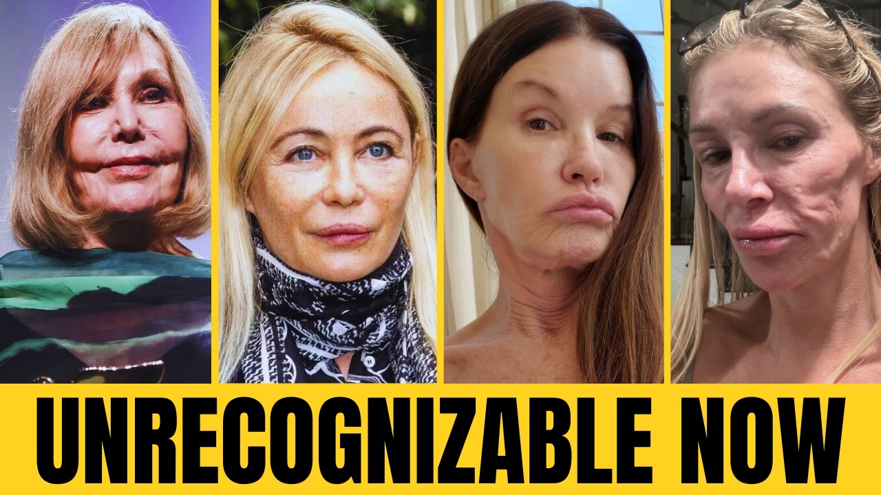 15 Celebrity Plastic Surgery Transformations That Went Too Far | Then and Now 2026