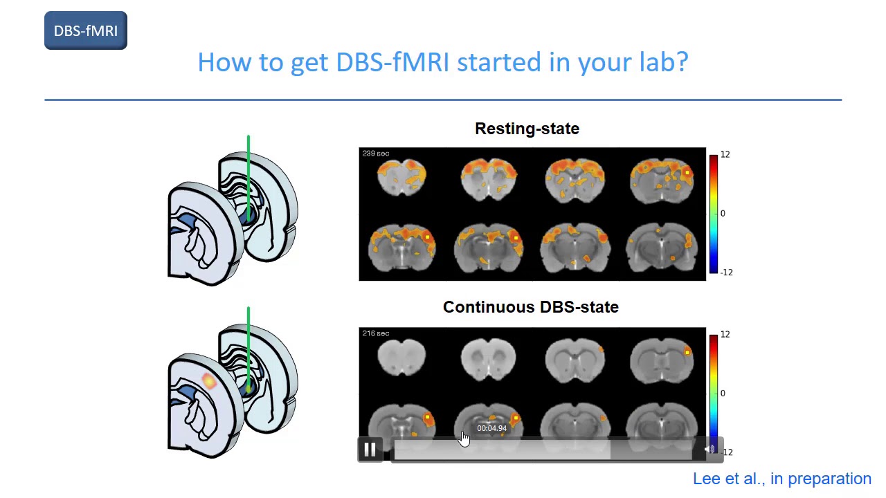 ISMRM MR Academy - Deep Brain Stimulation & Chemogenetic fMRI