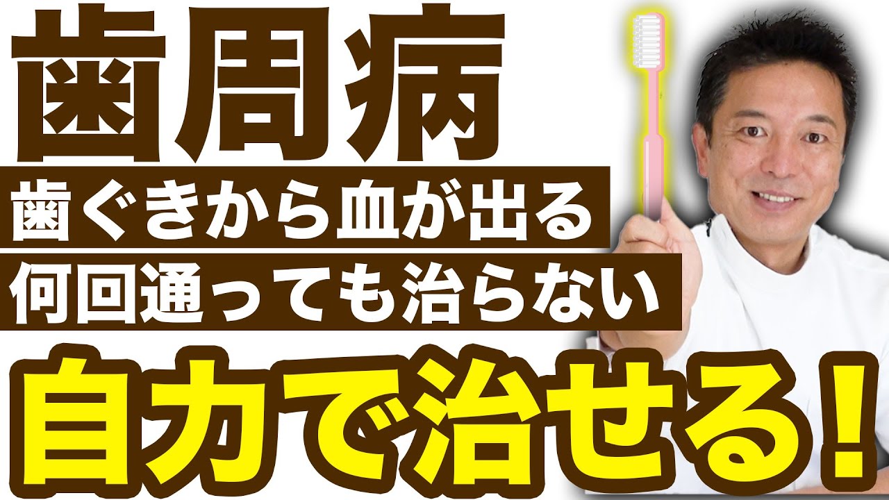 【自力で治す歯周病】歯周病は自力で治せる！【本当に治る】
