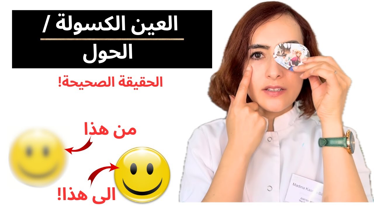العين الكسولة (الحول)! ماذا بالضبط يعني هذا؟ كيفية التعامل معها؟