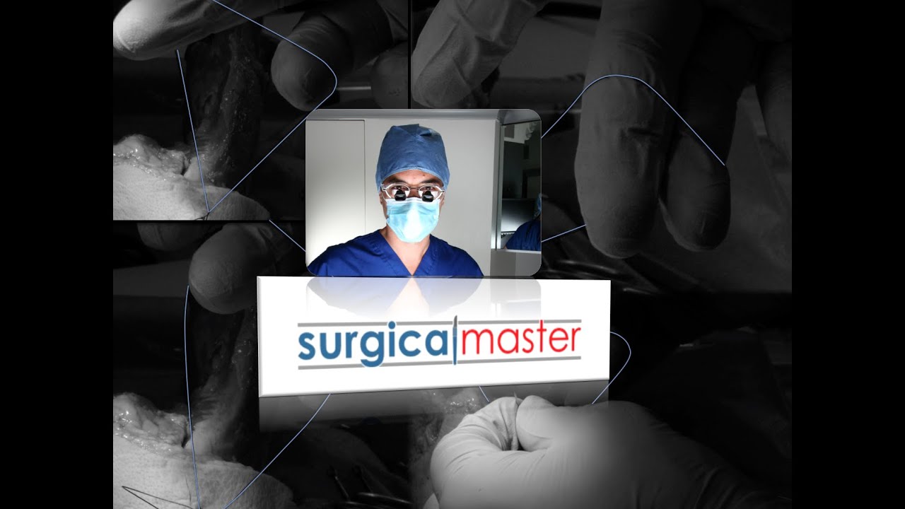 The continous suture PART 2 of 2 (THE SOLUTION FOR STABILITY)