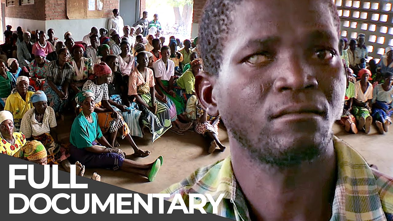 Unreported World: Malawi - Treating Blind People & South Africa - Skin Bleaching | Free Documentary