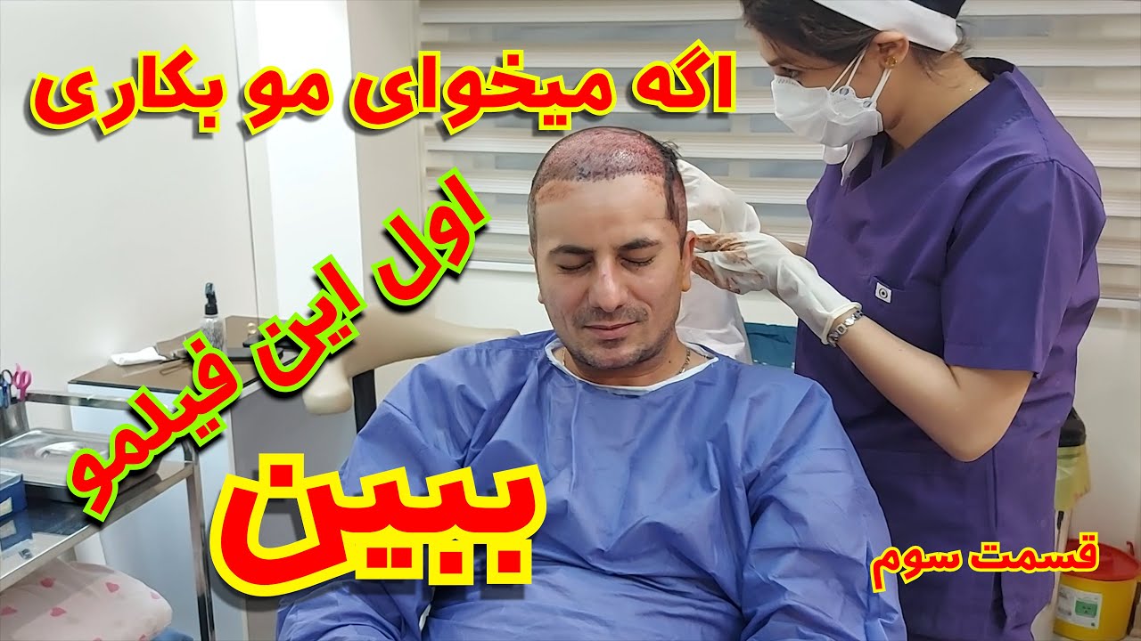کاشت مو در ایران قسمت سوم  😱 ازهمه چی فیلم گرفتم 😱جواب تمام سوالهای شما در مورد کاشت مو اینجاست 🤔