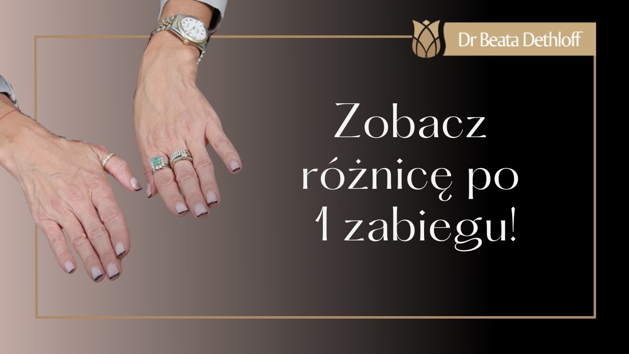 Nietypowe okolice, które zdradzają nasz wiek. Rozmowa Tomka Jacykowa z dr Beatą Dethloff.