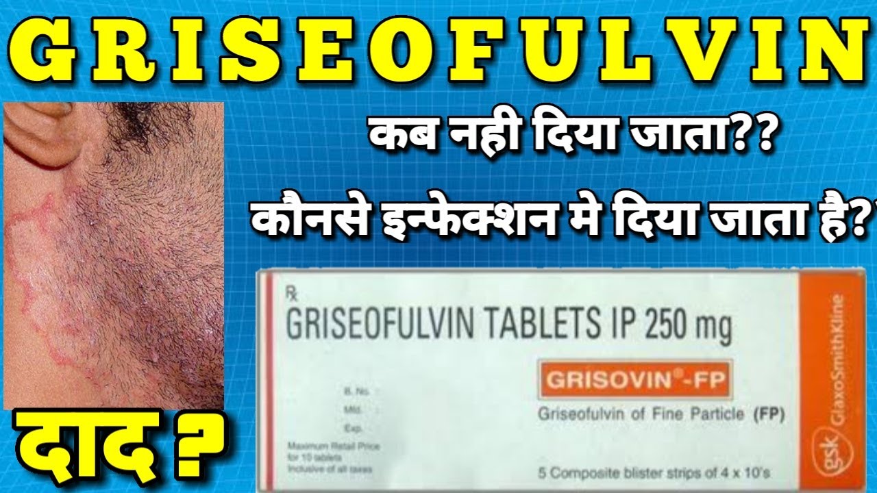 Grisovin tablets | Griseofulvin tablet | griseofulvin 250 mg tablet uses, side effects, dose