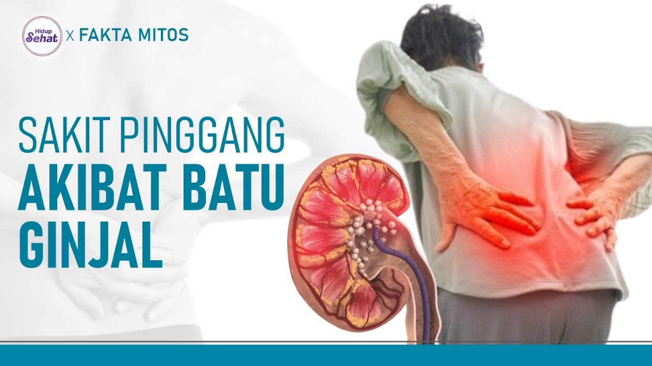 Ini Bedanya Sakit Pinggang Biasa dengan Gejala Batu Ginjal | Hidup Sehat tvOne