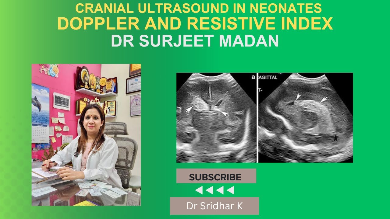 Doppler and resistive index on cranial ultrasound #nicu